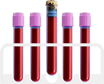 Test tubes Rack of test tubes with blood.